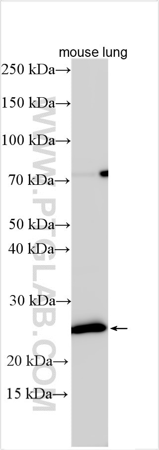 MS4A2 Antibody in Western Blot (WB)