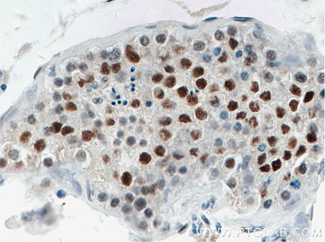 TP53RK Antibody in Immunohistochemistry (Paraffin) (IHC (P))