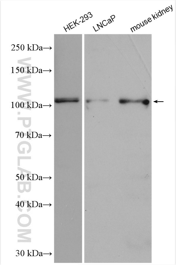 SLC12A9 Antibody in Western Blot (WB)