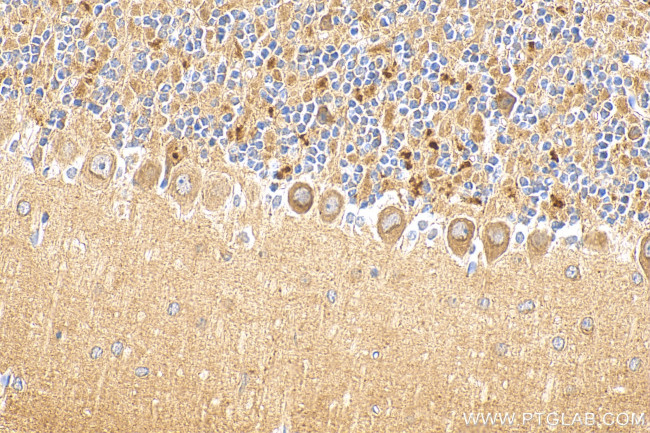 SUSD4 Antibody in Immunohistochemistry (Paraffin) (IHC (P))