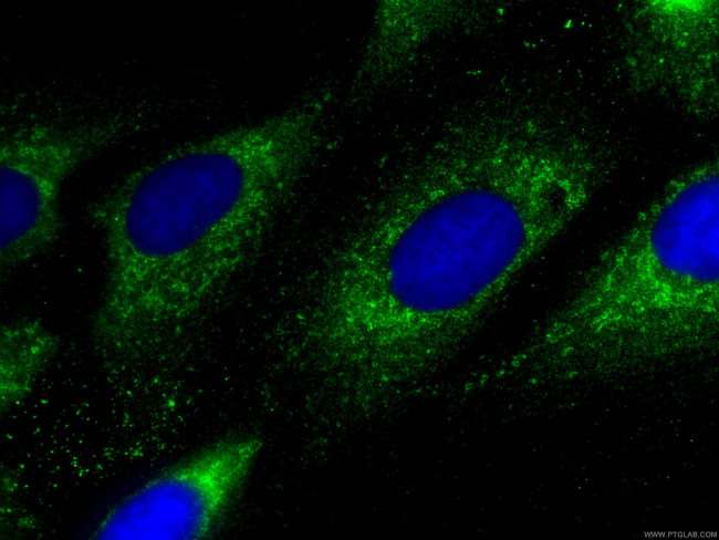 HAPLN1 Antibody in Immunocytochemistry (ICC/IF)