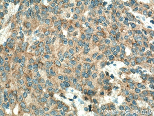 SLC22A16 Antibody in Immunohistochemistry (Paraffin) (IHC (P))