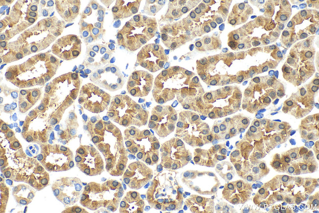 ACMSD Antibody in Immunohistochemistry (Paraffin) (IHC (P))
