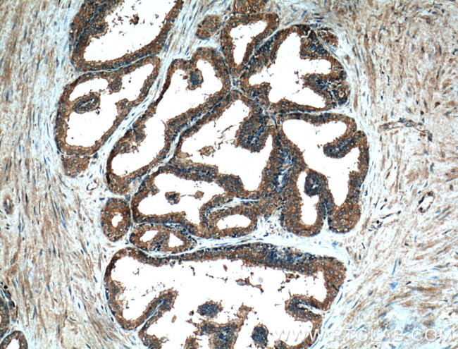 PLB1 Antibody in Immunohistochemistry (Paraffin) (IHC (P))