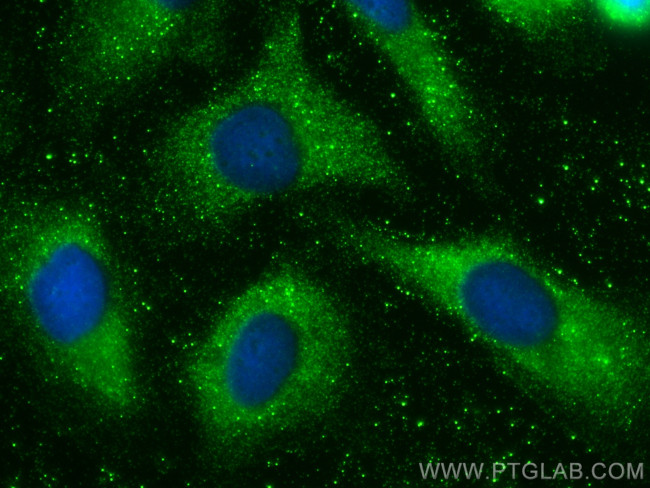 TIMP1 Antibody in Immunocytochemistry (ICC/IF)