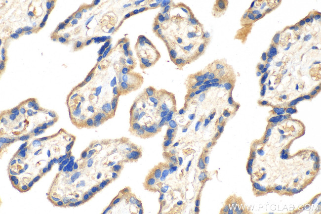 CRH/CRF Antibody in Immunohistochemistry (Paraffin) (IHC (P))