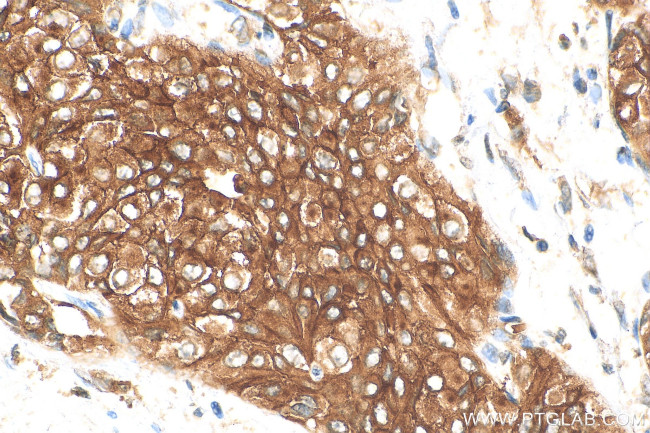 UPK1B Antibody in Immunohistochemistry (Paraffin) (IHC (P))