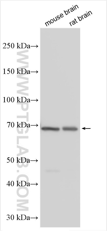 LRFN5 Antibody in Western Blot (WB)