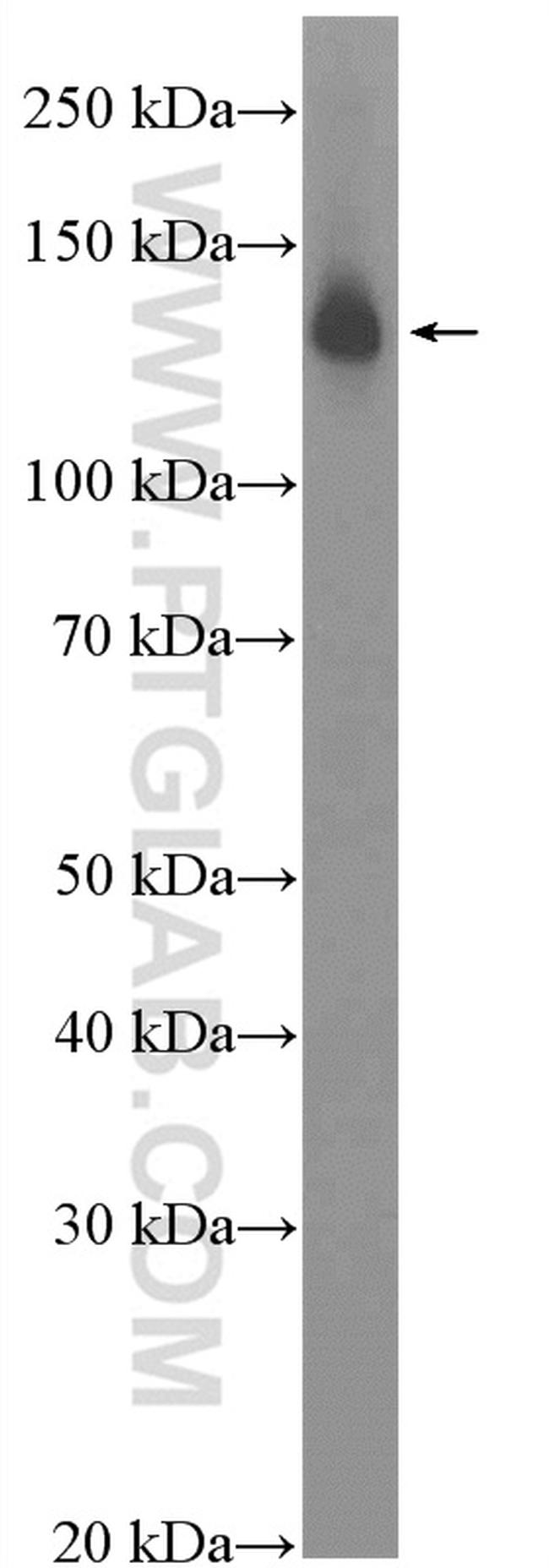 RFX1 Antibody in Western Blot (WB)
