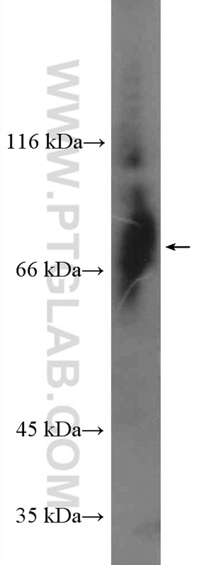 Bora Antibody in Western Blot (WB)