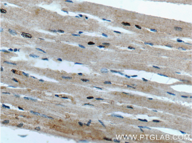 FAM175B Antibody in Immunohistochemistry (Paraffin) (IHC (P))