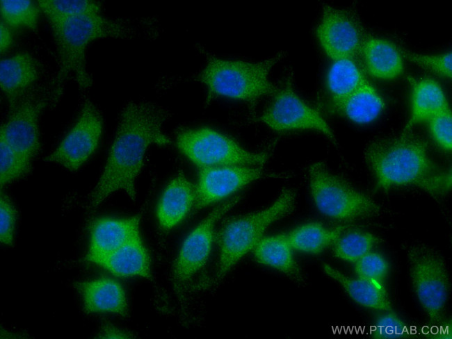 TIAM2 Antibody in Immunocytochemistry (ICC/IF)