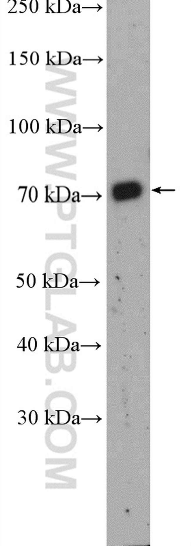 MATE 2 Antibody in Western Blot (WB)