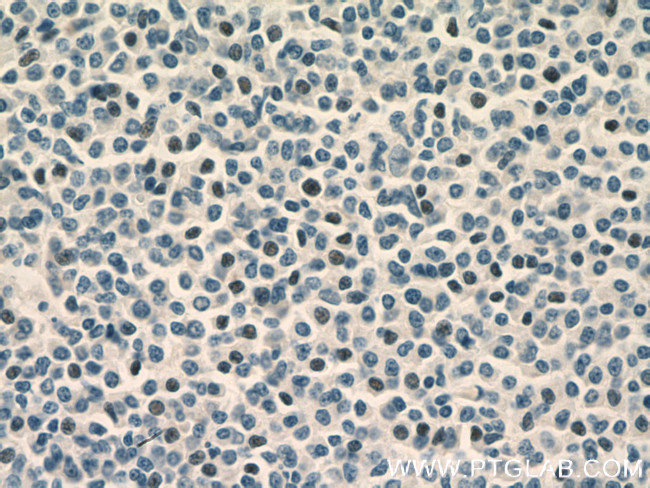 TLX1 Antibody in Immunohistochemistry (Paraffin) (IHC (P))