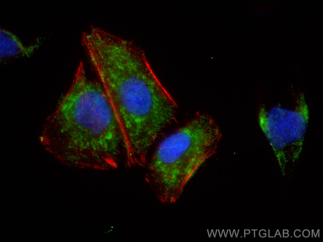 BRINP2 Antibody in Immunocytochemistry (ICC/IF)