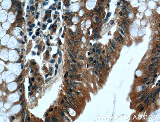 IFT22 Antibody in Immunohistochemistry (Paraffin) (IHC (P))