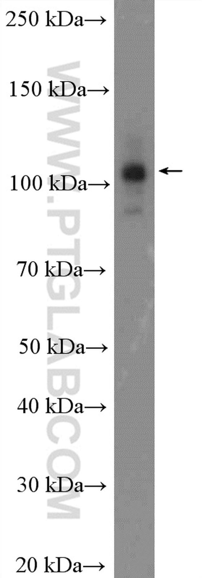 CWC22 Antibody in Western Blot (WB)
