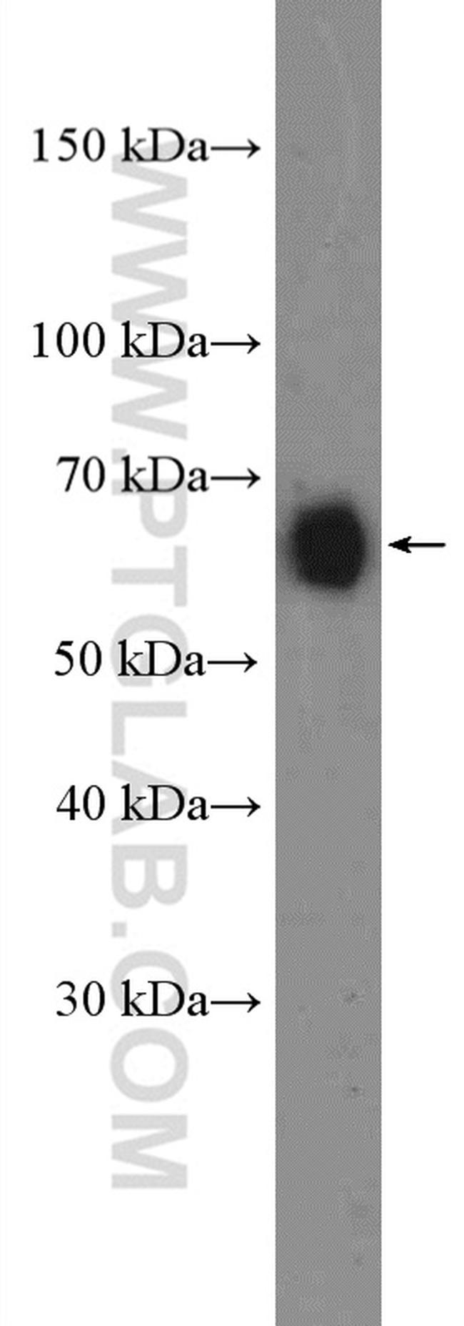 CD86 Antibody in Western Blot (WB)