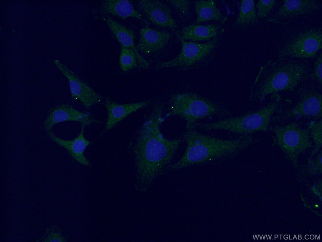 Neuronatin Antibody in Immunocytochemistry (ICC/IF)