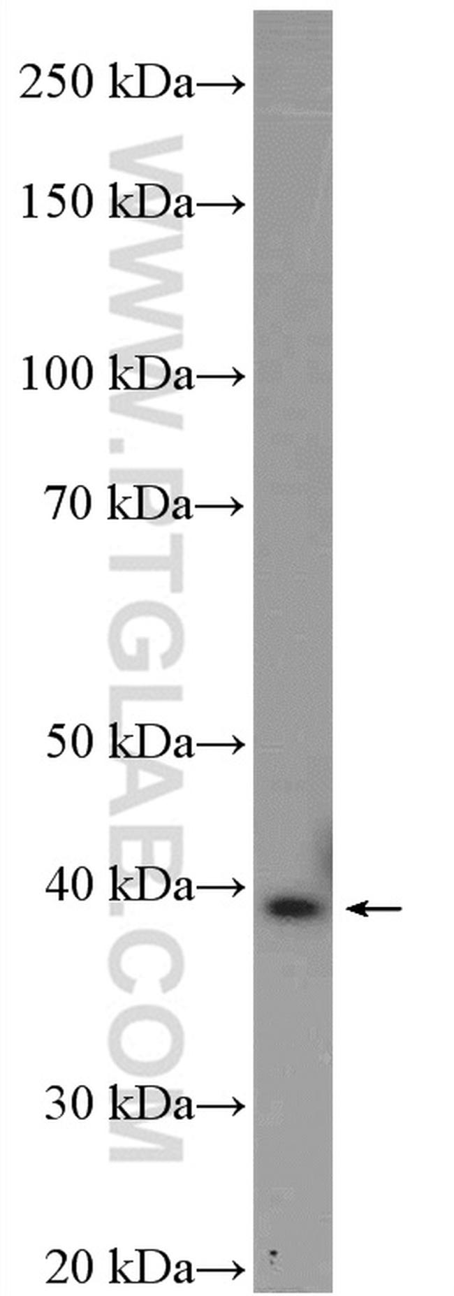 AMPK beta 1 Antibody in Western Blot (WB)