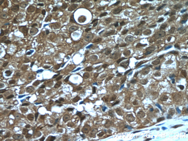 PSMD9 Antibody in Immunohistochemistry (Paraffin) (IHC (P))