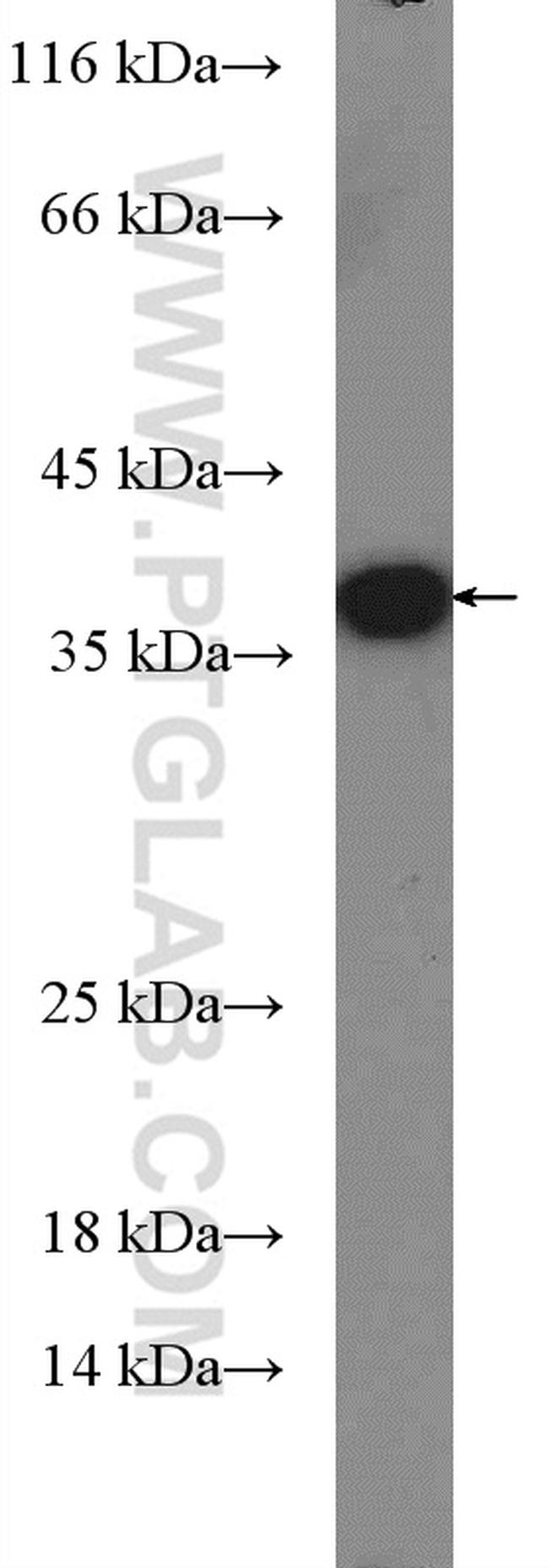 Sa Cas9 Antibody in Western Blot (WB)