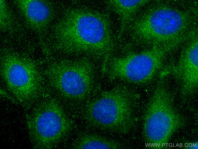 SPTB Antibody in Immunocytochemistry (ICC/IF)