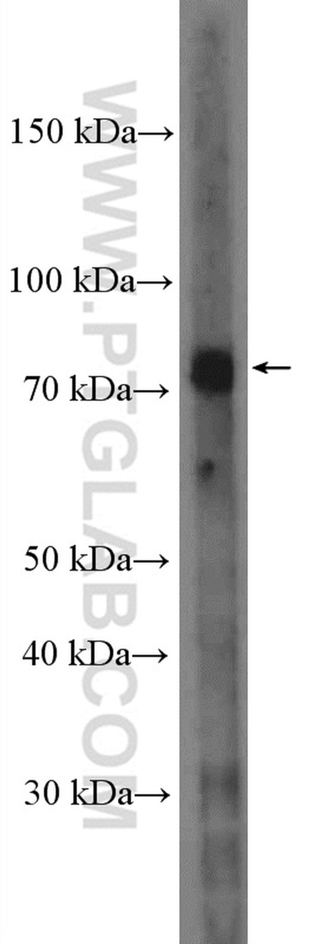 MTRR Antibody in Western Blot (WB)