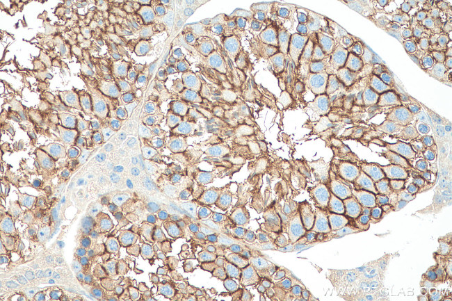 PRND Antibody in Immunohistochemistry (Paraffin) (IHC (P))