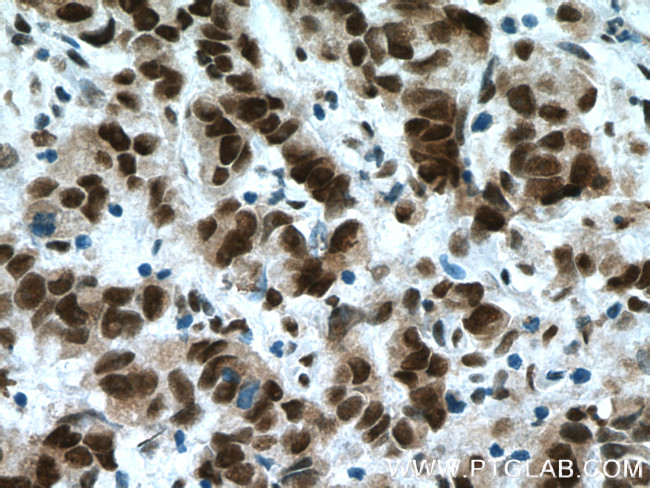 USP7 Antibody in Immunohistochemistry (Paraffin) (IHC (P))