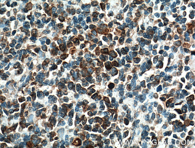 FCRLA Antibody in Immunohistochemistry (Paraffin) (IHC (P))
