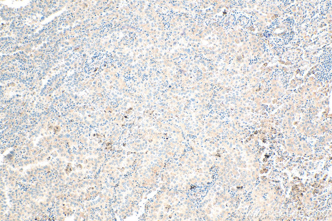 OR2H1 Antibody in Immunohistochemistry (Paraffin) (IHC (P))