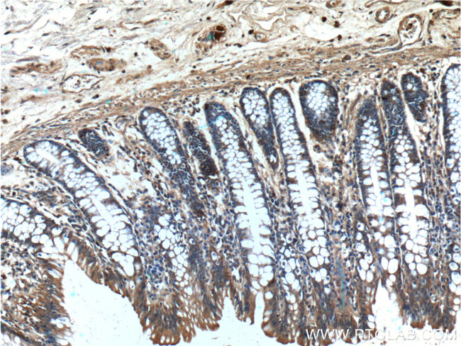 PAM Antibody in Immunohistochemistry (Paraffin) (IHC (P))