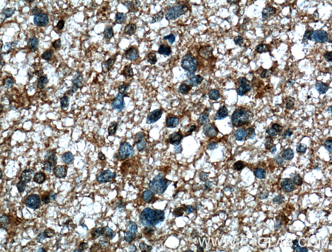 TTYH1 Antibody in Immunohistochemistry (Paraffin) (IHC (P))