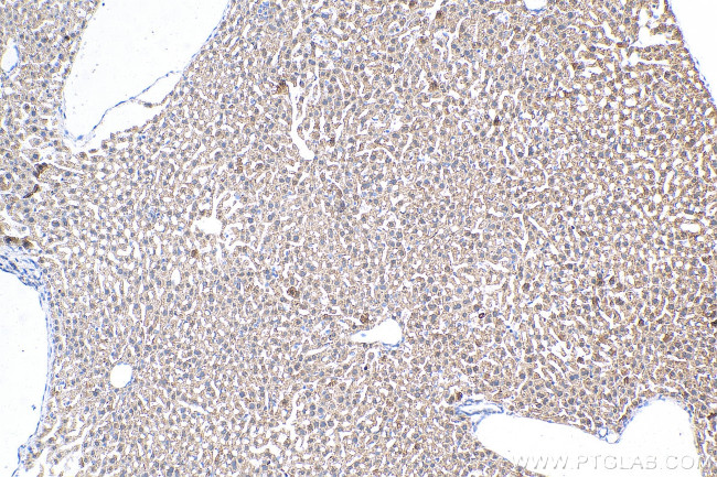 COL10A1 Antibody in Immunohistochemistry (Paraffin) (IHC (P))