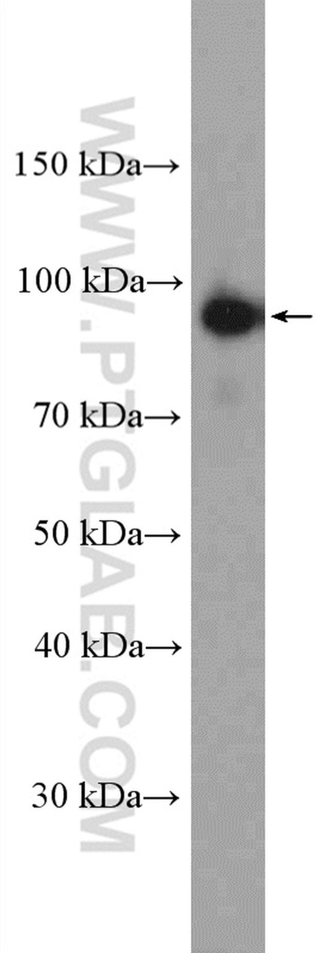 Calpain 7 Antibody in Western Blot (WB)