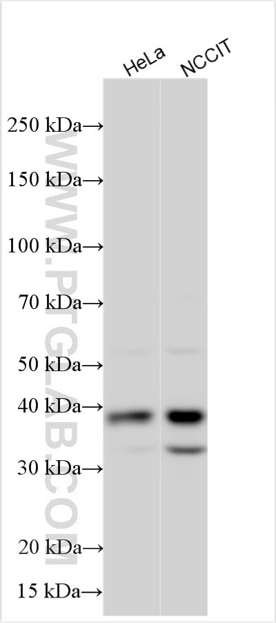 TCTEX1D2 Antibody in Western Blot (WB)