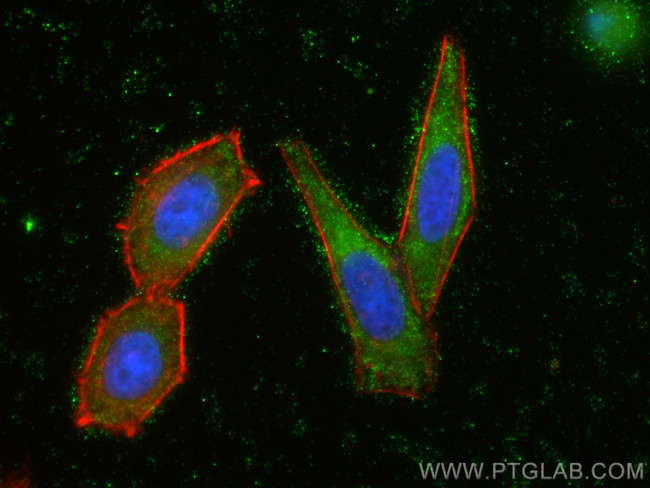 RASGRP1 Antibody in Immunocytochemistry (ICC/IF)