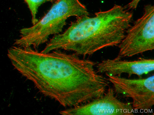 NUDT5 Antibody in Immunocytochemistry (ICC/IF)