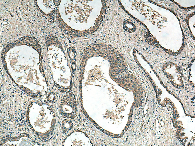 RNF113A Antibody in Immunohistochemistry (Paraffin) (IHC (P))