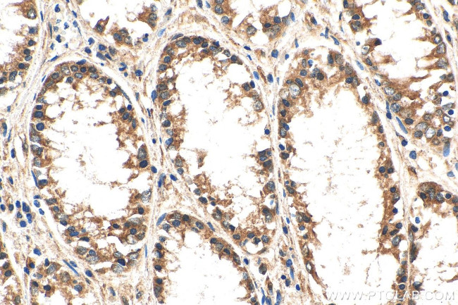 SVCT2 Antibody in Immunohistochemistry (Paraffin) (IHC (P))