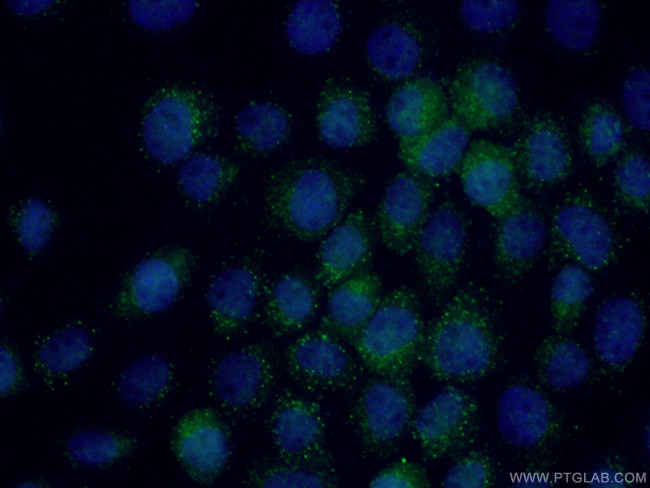 SHQ1 Antibody in Immunocytochemistry (ICC/IF)