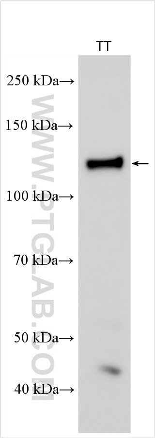 GPNMB Antibody in Western Blot (WB)