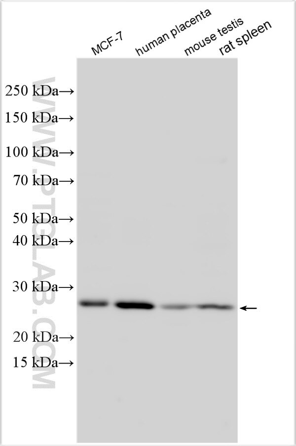 TAF5 Antibody in Western Blot (WB)