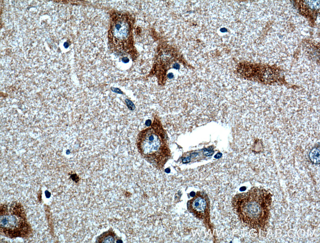 FIBIN Antibody in Immunohistochemistry (Paraffin) (IHC (P))