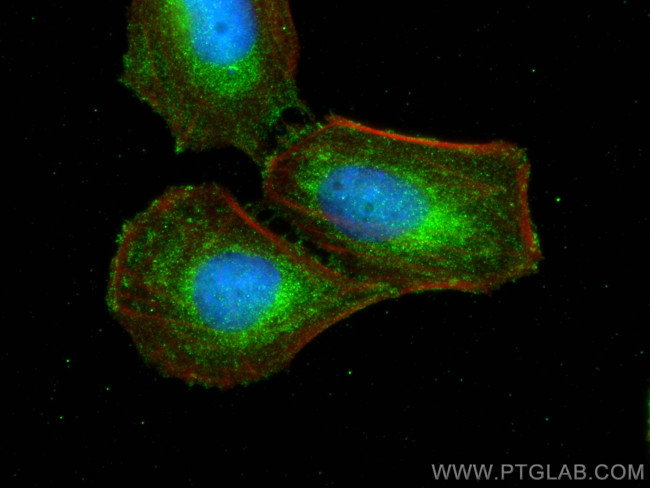PTGIS Antibody in Immunocytochemistry (ICC/IF)