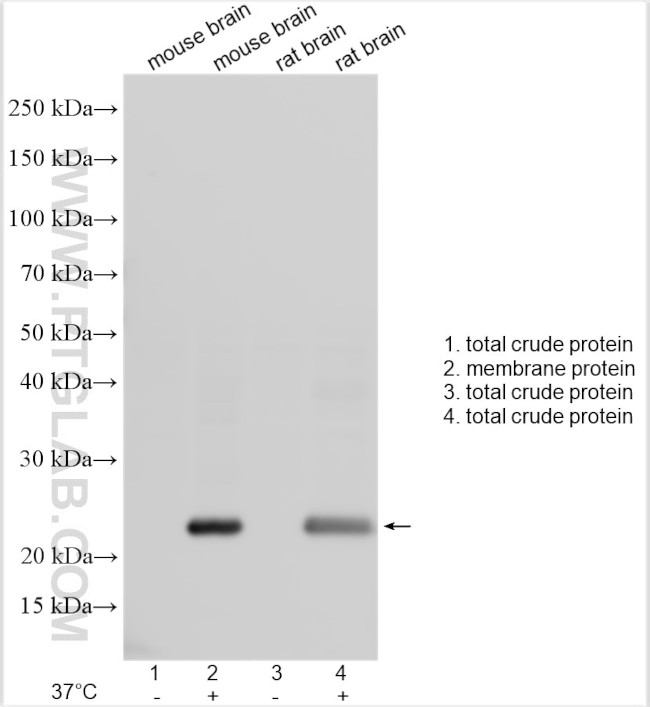 NIPA1 Antibody in Western Blot (WB)