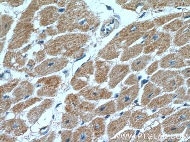 AHNAK2 Antibody in Immunohistochemistry (Paraffin) (IHC (P))