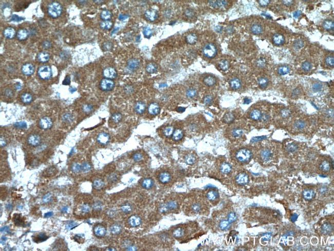 TTPA Antibody in Immunohistochemistry (Paraffin) (IHC (P))