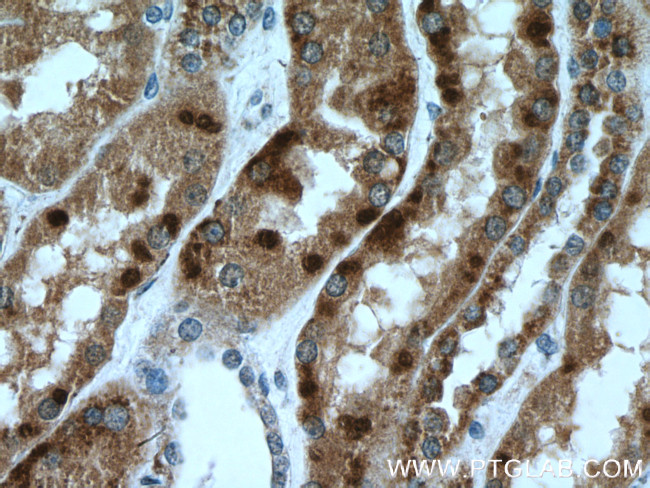 ISOC2 Antibody in Immunohistochemistry (Paraffin) (IHC (P))